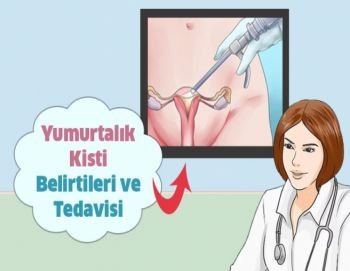 Yumurtalık Kisti Tedavisi